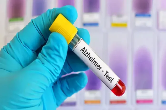 Fda Approves First Ever Blood Test For Alzheimer’s Diagnosis Fda Approves First Ever Blood Test For Alzheimer’s Diagnosis